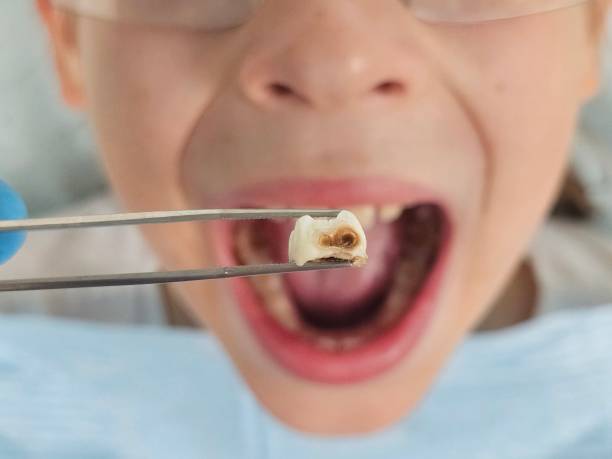 Best Emergency Treatment for Jaw Pain or Injury in San Antonio, FL